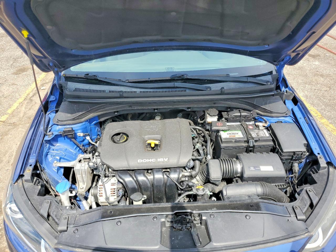 2017 HYUNDAI ELANTRA — фото 11